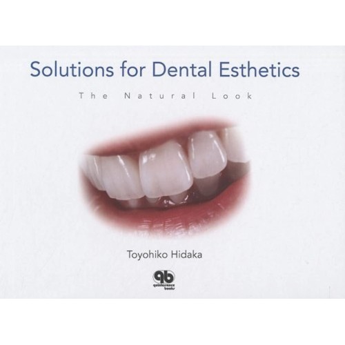 Solutions For Dental Esthetics The Natural Lo...