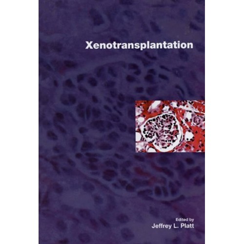 Xenotransplantation (Hb) 