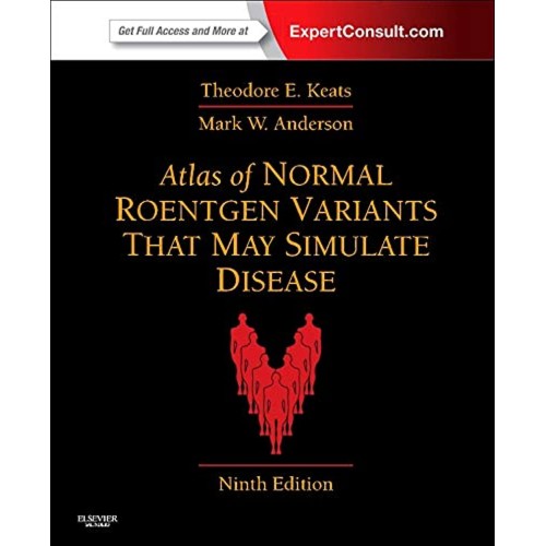 Atlas Of Normal Roentgen Variants That May Si...