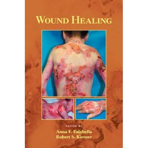 Wound Healing 