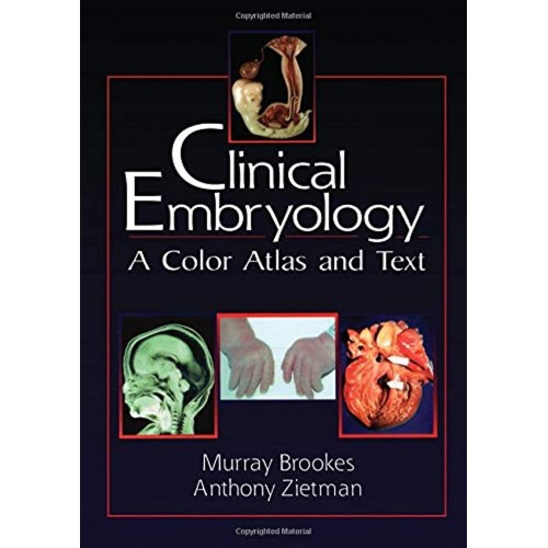 Clinical Embryology: A Color Atlas And Text 