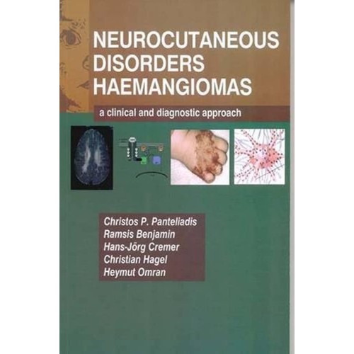 Neurocutaneous Disorders-Hemangiomas 