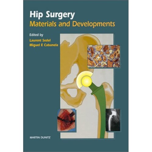 Hip Surgery: New Materials And Developments 