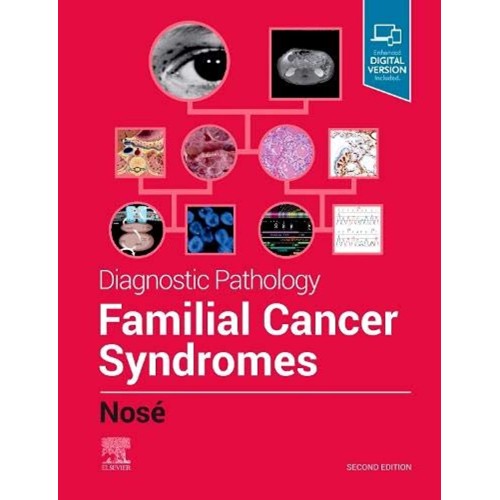 Diagnostic Pathology Familial Cancer Syndrome...