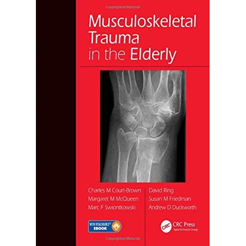 Musculoskeletal Trauma In The Elderly With Ac...