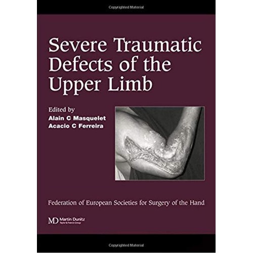 Severe Traumatic Defects Of The Upper Limb (H...