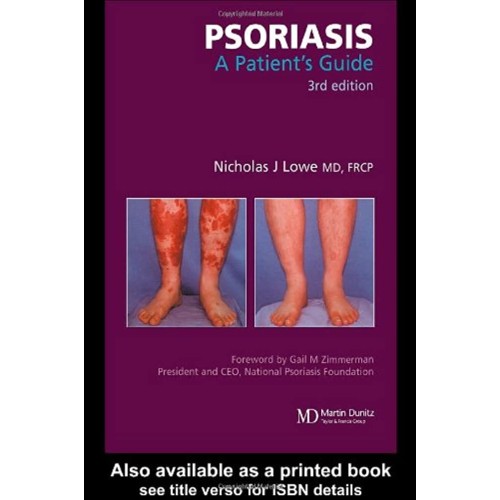 Psoriasis: A Patient'S Guide 