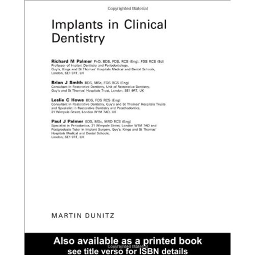 Implants In Clinical Dentistry 