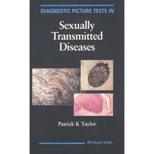 Diagnostic Picture Tests In Sexually Transmit...