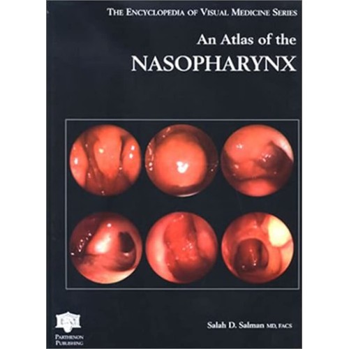 An Atlas Of The Nasopharynx (Encyclopedia Of ...