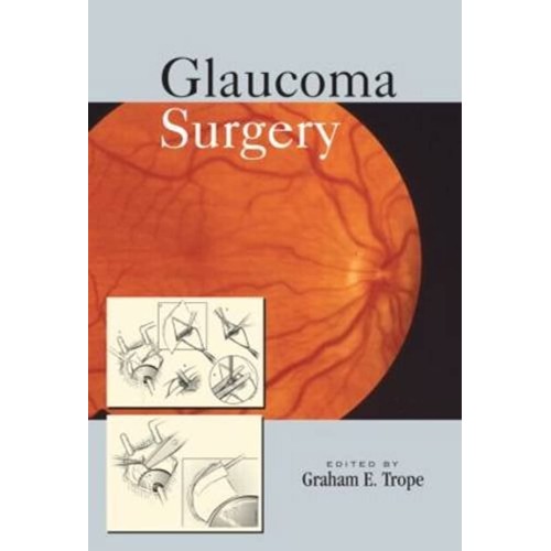 Glaucoma Surgery 