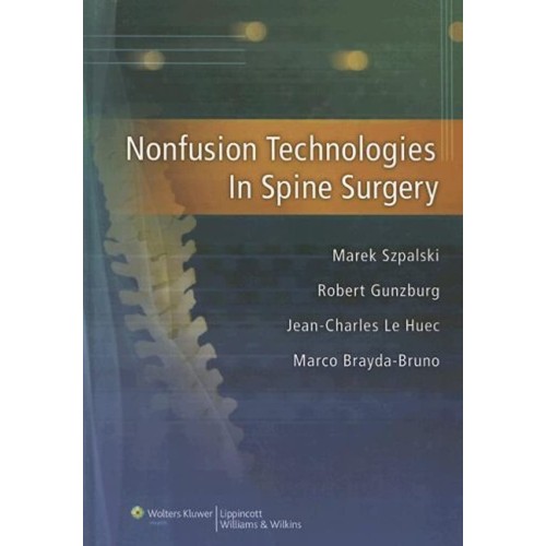 Nonfusion Technologies In Spine Surgery (Hb) ...