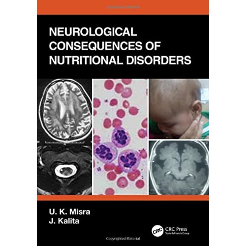 Neurological Consequences Of Nutritional Diso...