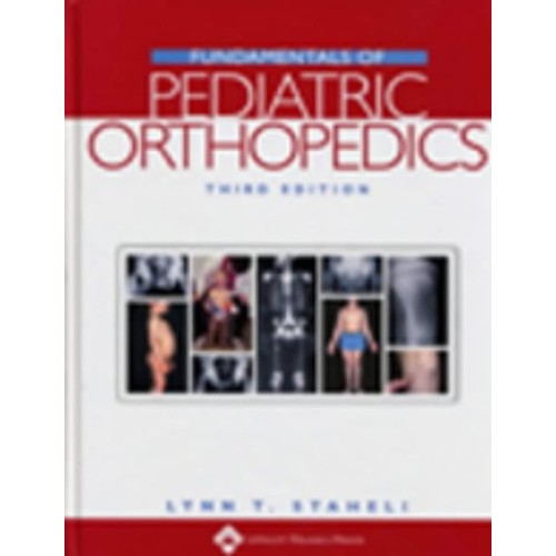 Fundamentals Of Pediatric Orthopedics, 3/E 