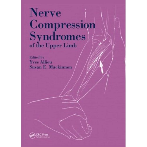 Nerve Compression Syndromes Of The Upper Limb...