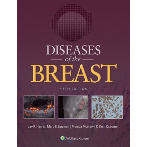 Diseases Of The Breast 5Ed (Hb 2014) 