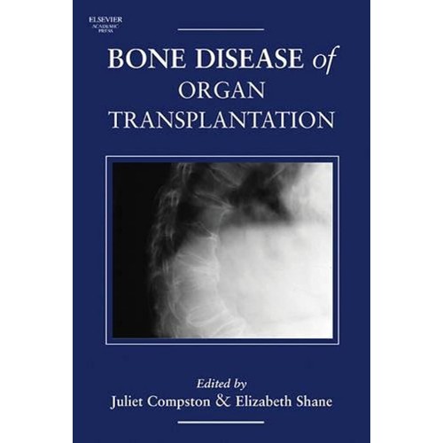 Bone Disease Of Organ Transplantation (Hb 200...