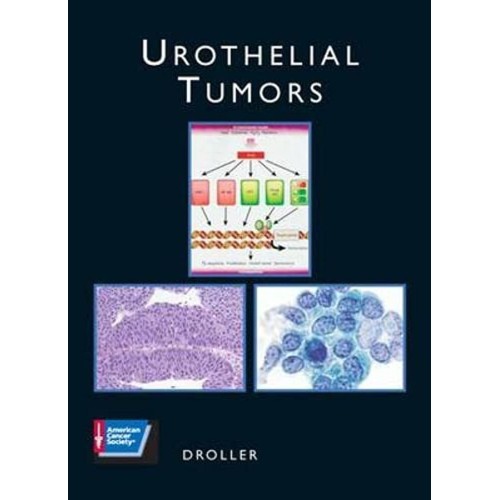 Urothelial Tumors (Acs Atlas Of Clinical Onco...