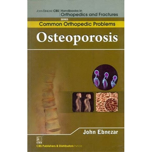 Osteoporosis (Handbooks In Orthopedics And Fr...