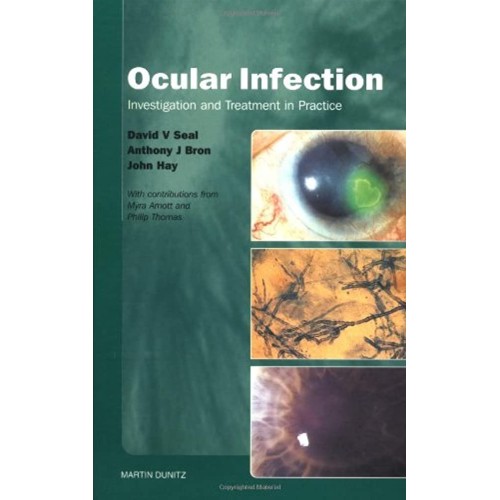 Ocular Infection: Management And Treatment In...