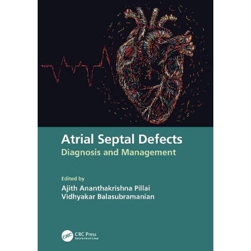 Atrial Septal Defects Diagnosis And Managemen...