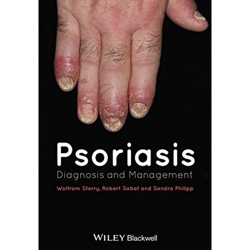 Psoriasis Diagnosis And Management (Hb 2014) 