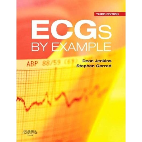 Ecgs By Example 3Ed (Pb 2018)