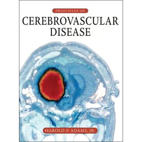 Principles Of Cerebrovascular Disease (Hb 200...