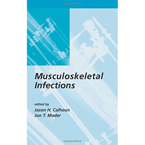 Musculoskeletal Infections 