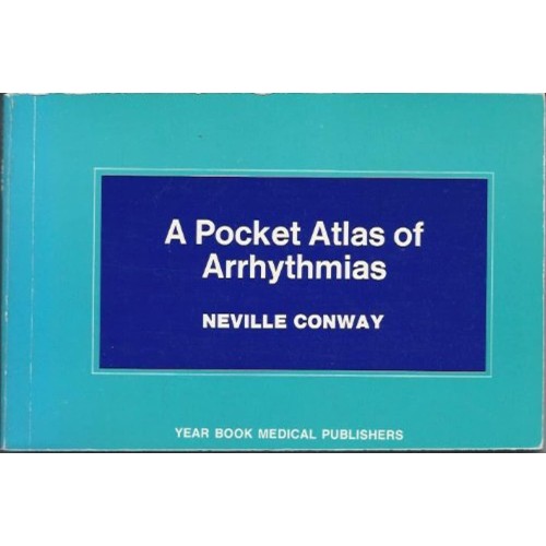 A Pocket Atlas Of Arrhythmias 