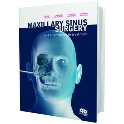 Maxillary Sinus Surgery And Alternatives In T...