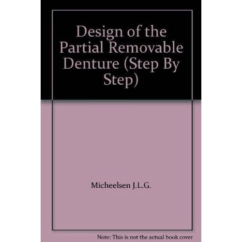 Design Of The Partial Removable Denture Step ...