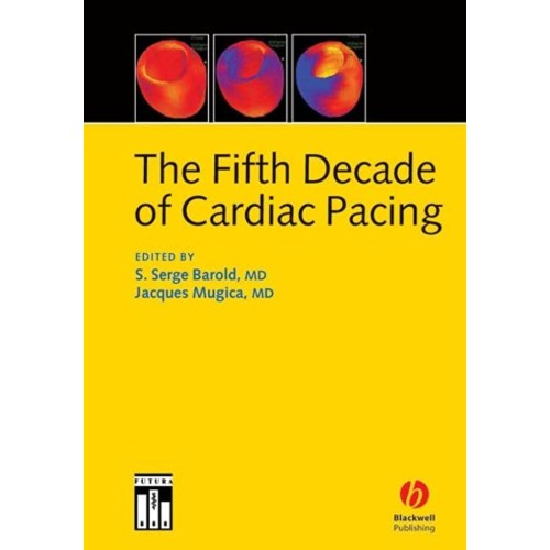 The Fifth Decade Of Cardiac Pacing 