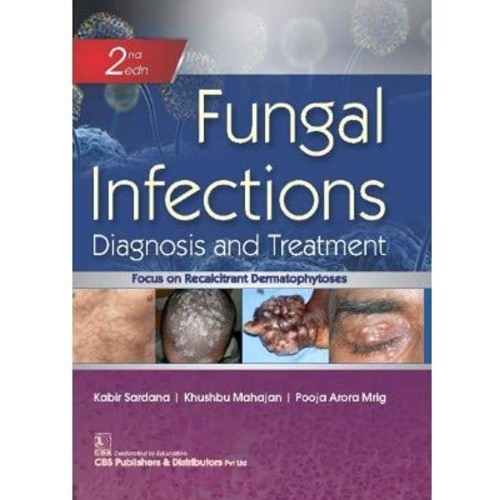 Fungal Infections Diagnosis And Treatment 2Ed...