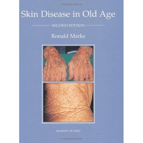 Skin Disease In Old Age 