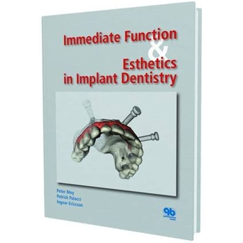 Immediate Function And Esthetics In Implant D...