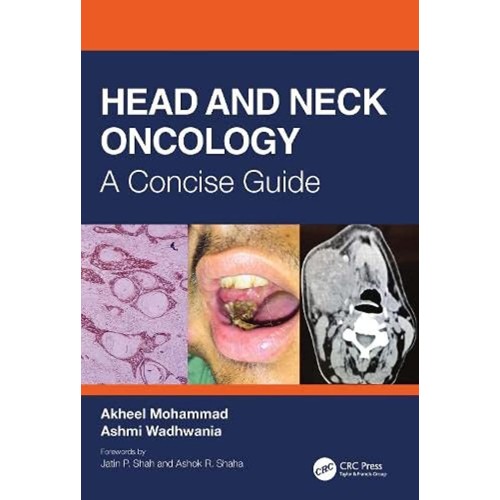 Head And Neck Oncology A Concise Guide (Pb 20...