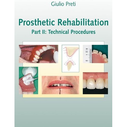 Prosthetic Rehabilitation Part Ii Technical P...