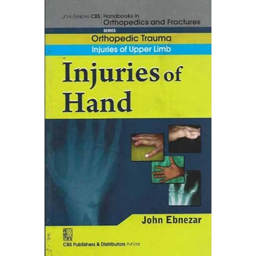 Injuries Of Hand (Handbooks In Orthopedics An...