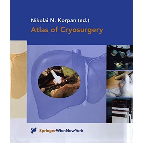 Atlas Of Cryosurgery 