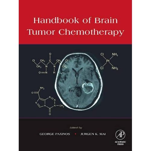 Handbook Of Brain Tumor Chemotherapy 