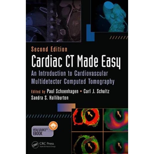 Cardiac Ct Made Easy An Introduction To Cardi...