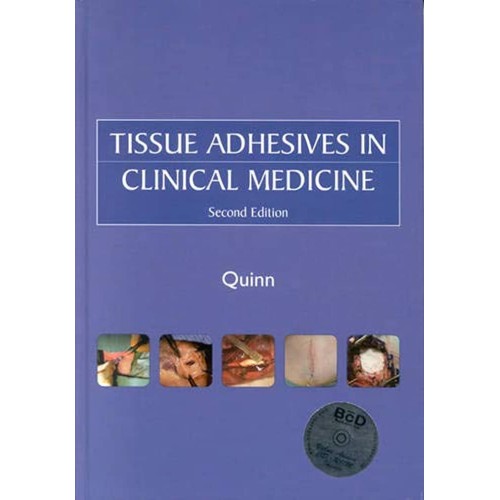 Tissue Adhesives In Clinical Medicine 