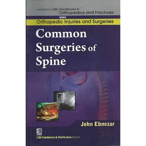 Common Surgeries Of Spine (Handbooks In Ortho...