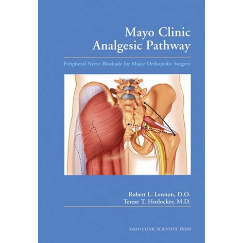 Mayo Clinic Analgesic Pathway Peripheral Nerv...