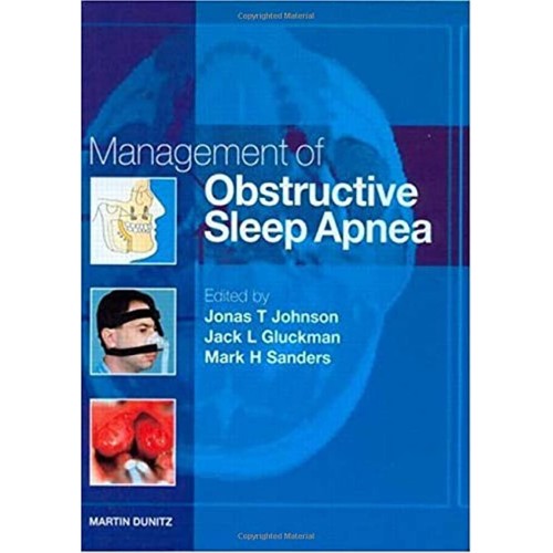 Obstructive Sleep Apnoea 