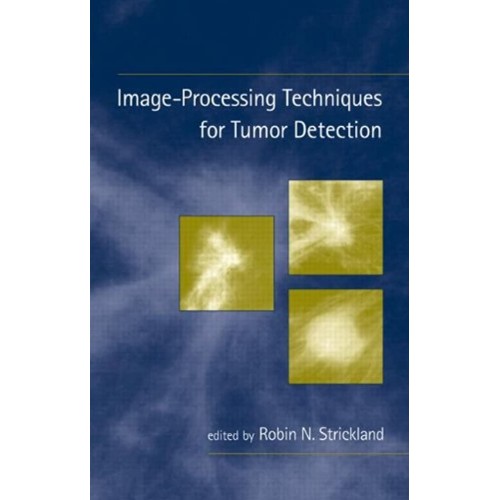 Image Processing Techniques For Tumor Detecti...