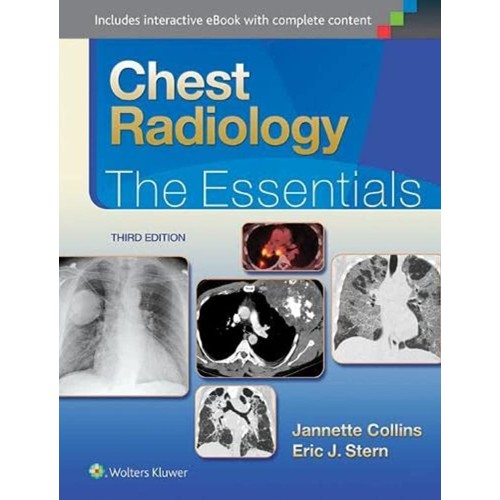 Chest Radiology The Essentials 3Ed (Hb 2015) 