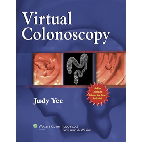 Virtual Colonoscopy (Hb) 