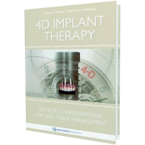 4D Implant Therapy Esthetic Considerations Fo...